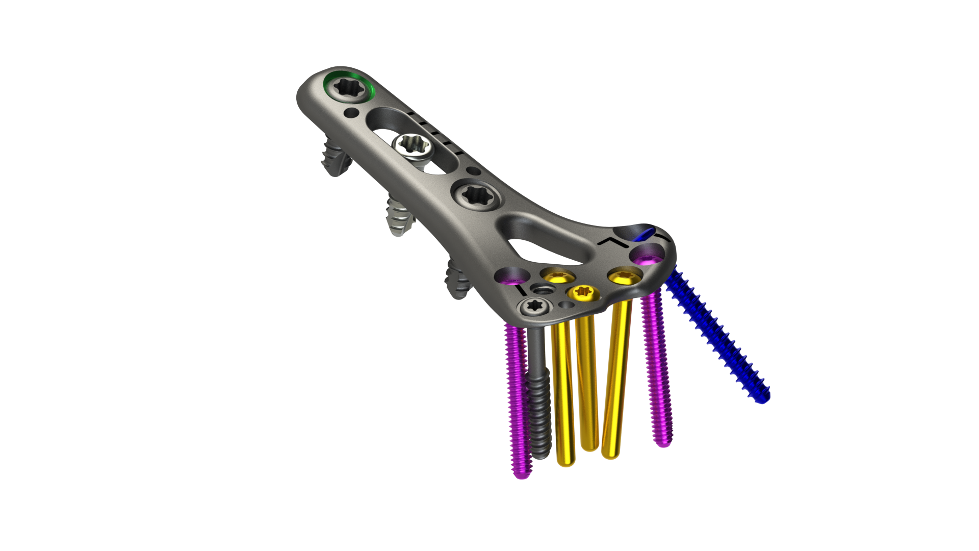 DRPx Distal Radius Plating System Titanium Implants