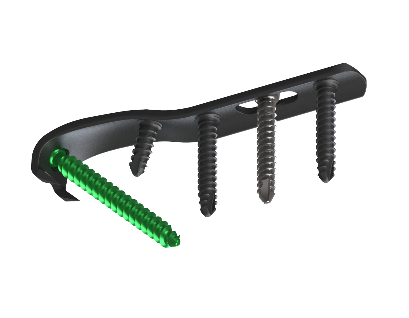 ANKx Ankle Fixation Implant System Distal Fibula Plates
