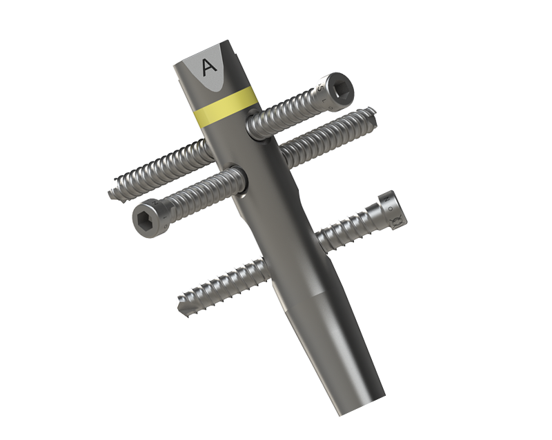 Intramedullary Tibial Nail System