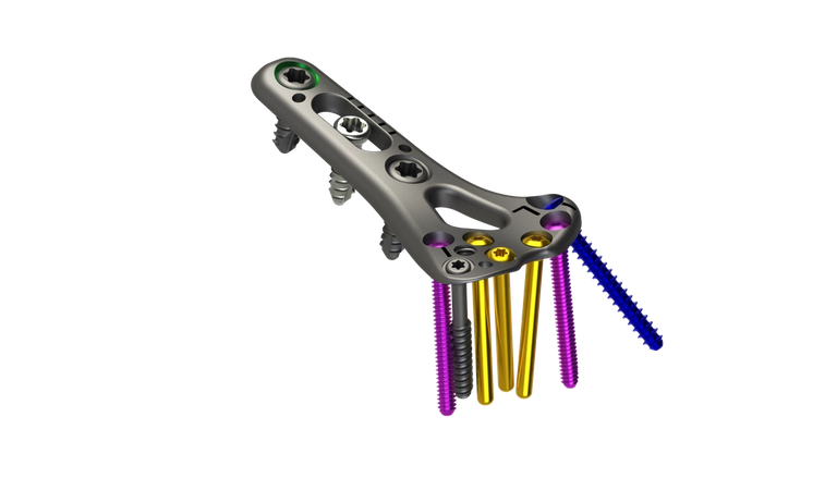 DRPx Wrist Fracture Volar Plate