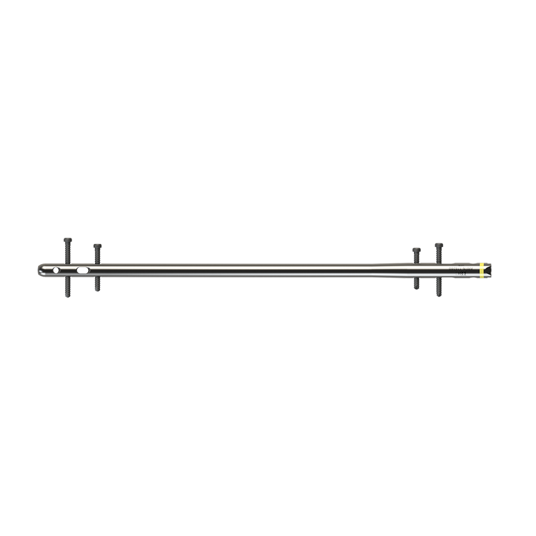 Antegrade and Retrograde Femoral Intramedullary Nail System
