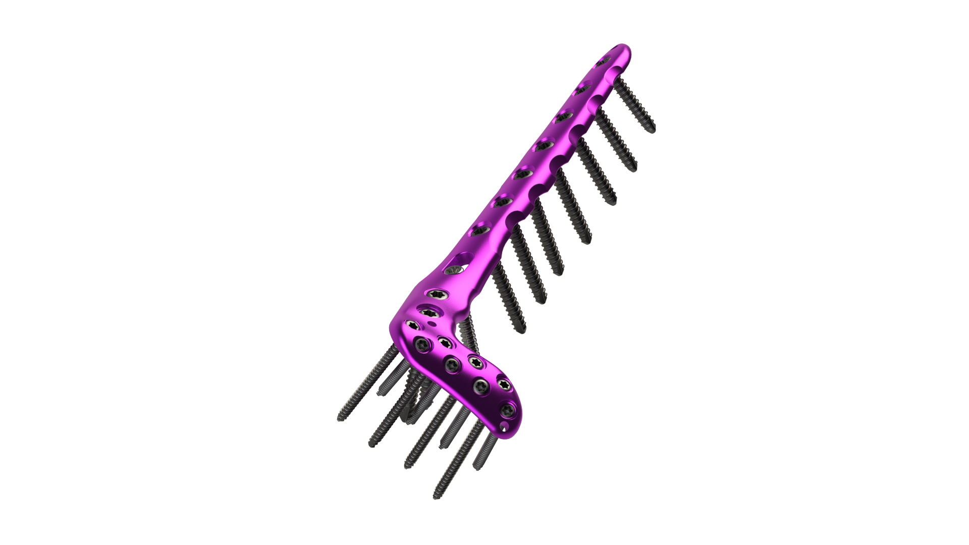 Distal Tibia Anterolateral and Medial Locking Plates